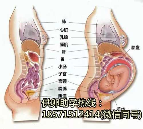 江苏有代孕中心吗,孕期远离痔疮的4个妙招