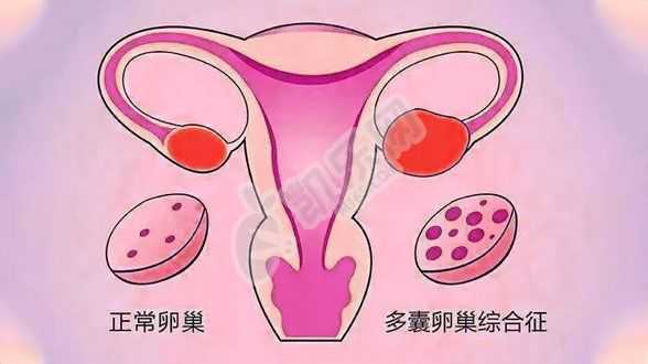 大连供卵机构助孕,卵巢功能早衰怎么治